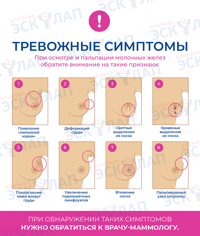 Тревожные признаки при самостоятельной пальпации груди.png